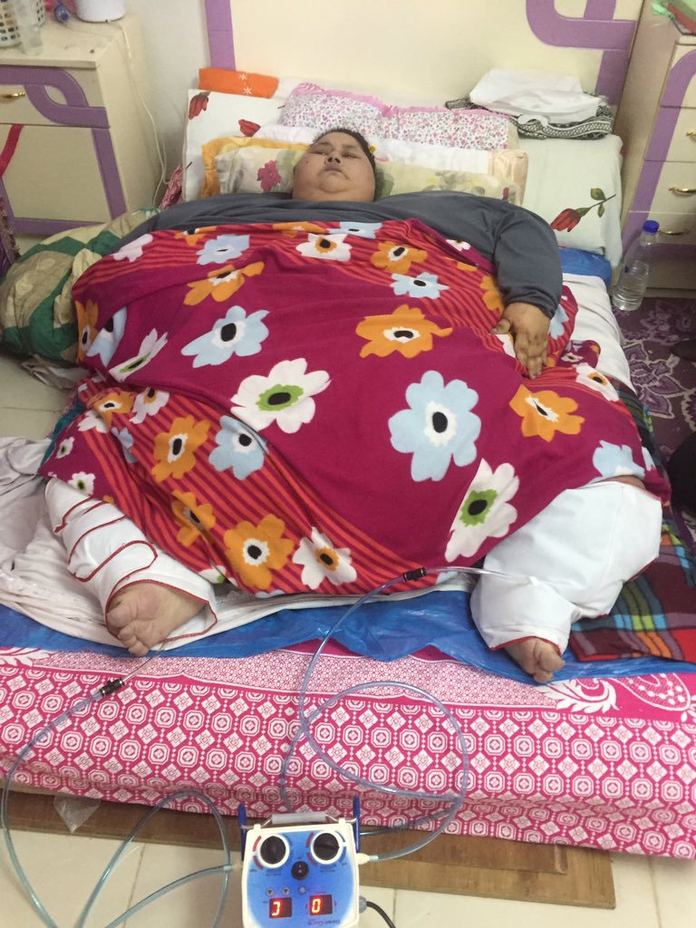 Une Egyptienne qui pèse 500kg va être opérée en Inde