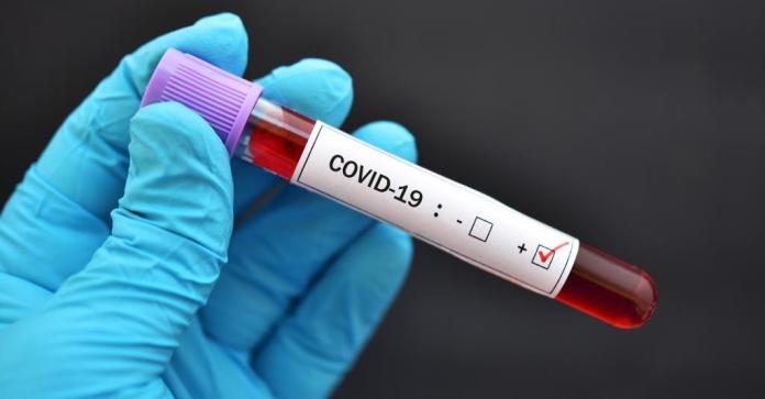 Coronavirus: Campagne de dépistage rapide et gratuit à Hammamet