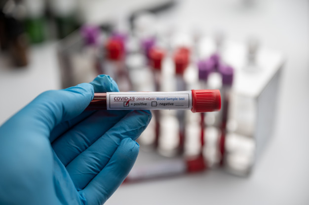 Tunisie: 2617 nouvelles contaminations et un taux de positivité de 23,63%