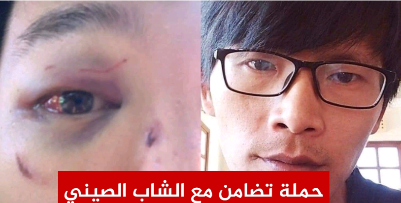Campagne de soutien au jeune chinois agressé à Tunis