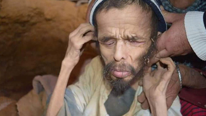 Incroyable mais vrai : découvert dans une grotte un quinquagénaire ne pèse que 10kg