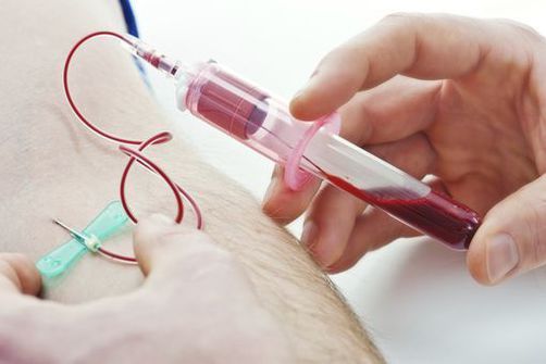 L'OMS met l'accent sur le diagnostic précoce du cancer