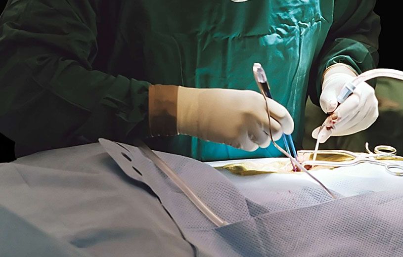 Insolite: Un homme se fait retirer 40 couteaux de l'estomac