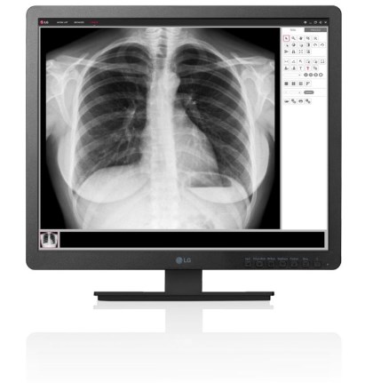 LG dévoile sa vaste gamme d’appareils d’imagerie médicale au Medica 2017