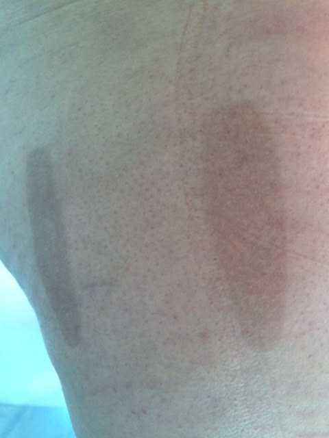 De nouveaux dégâts dans les Centres d'esthétique non médicalisés