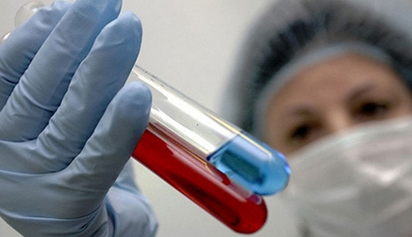 Kairouan: 6 collégiens touchés par la gale 