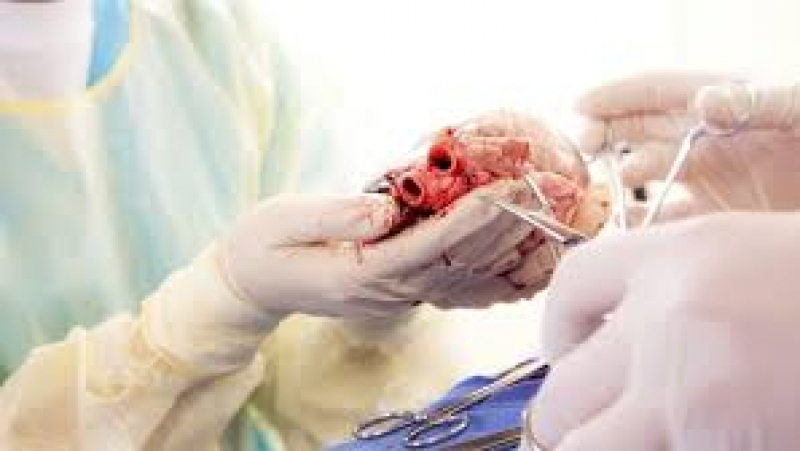 Transplantation réussie d'un cœur à la Rabta : l’émouvant coup de cœur