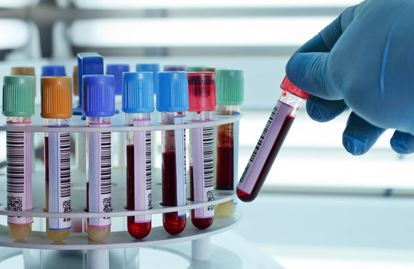 Tunisie: 472 nouvelles contaminations et un taux de positivité de 7,78%