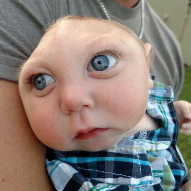 Le bébé qui défie les lois de la... médecine