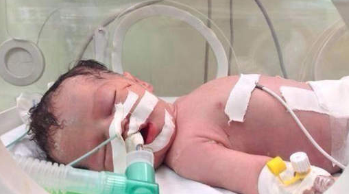 Gaza: Un bébé miraculé naît 10 minutes après la mort de sa mère