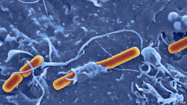 La maladie "Shigella sonnei" : Recommandations du ministère de la Santé