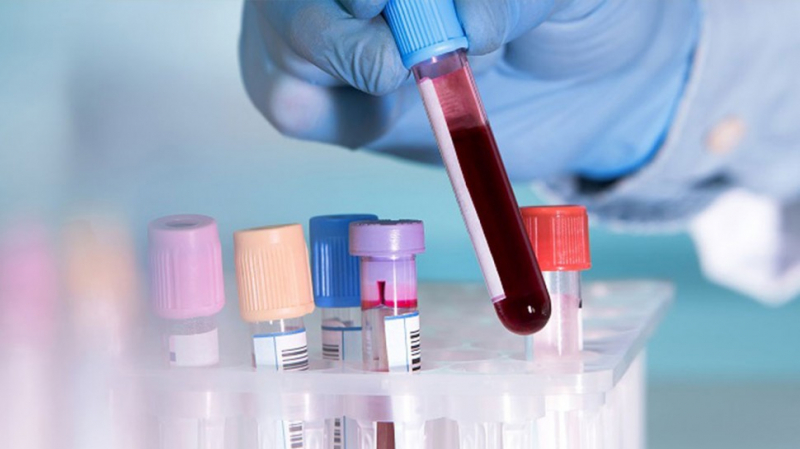 Cinq nouveaux cas de coronavirus importés et confinés à Monastir