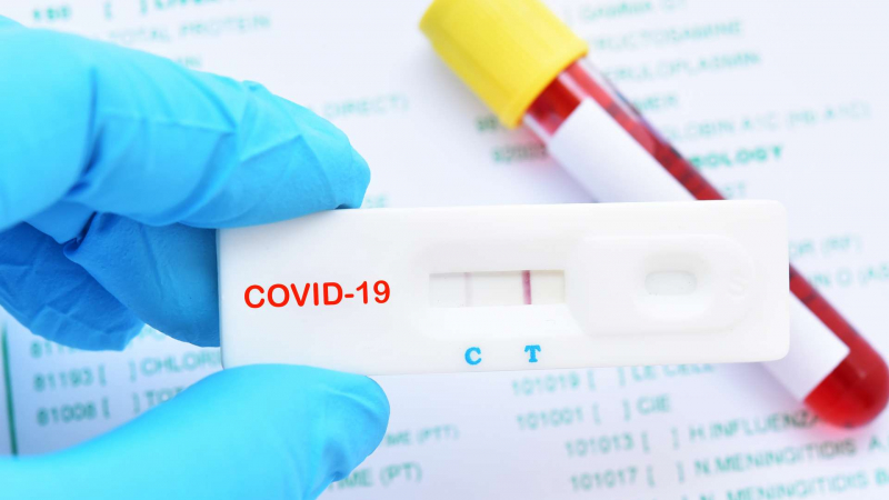 Tunisie: Les tests rapides de coronavirus pas si efficaces que ça !