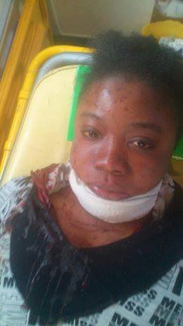 Agression raciste en Tunisie: Une étudiante congolaise entre la vie et la mort