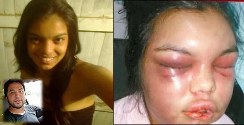 Passée à tabac par son mari pour chaque "Like" reçu sur Facebook