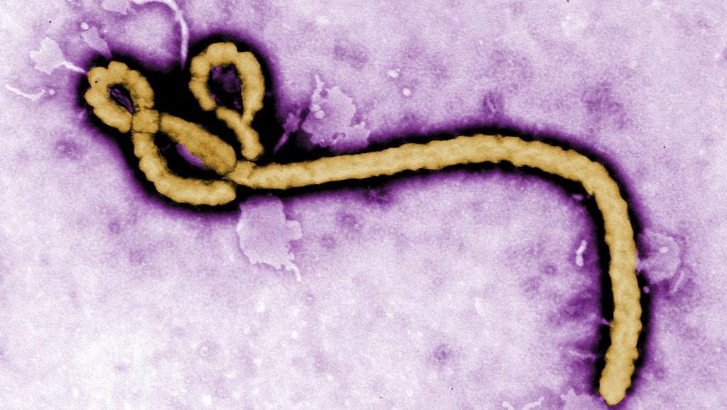Ce gang de voleurs emporte, sans le savoir, un échantillon du... virus Ebola