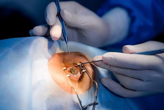 La Tunisie, pionnière africaine en chirurgie esthétique oculaire