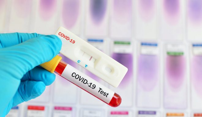 Covid-19 : Un taux de 20% de cas positifs enregistrés lors de la campagne de tests rapides 